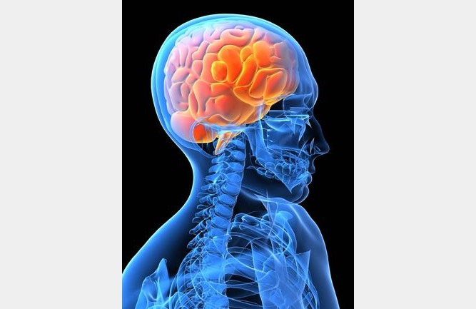 Cerebro-RX