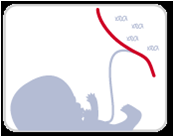 Test prenatal no invasivo