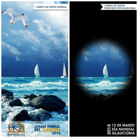 D&iacute;a Mundial del Glaucoma