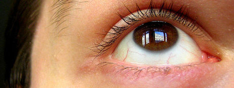 Alergia ocular y conjuntivitis estacional